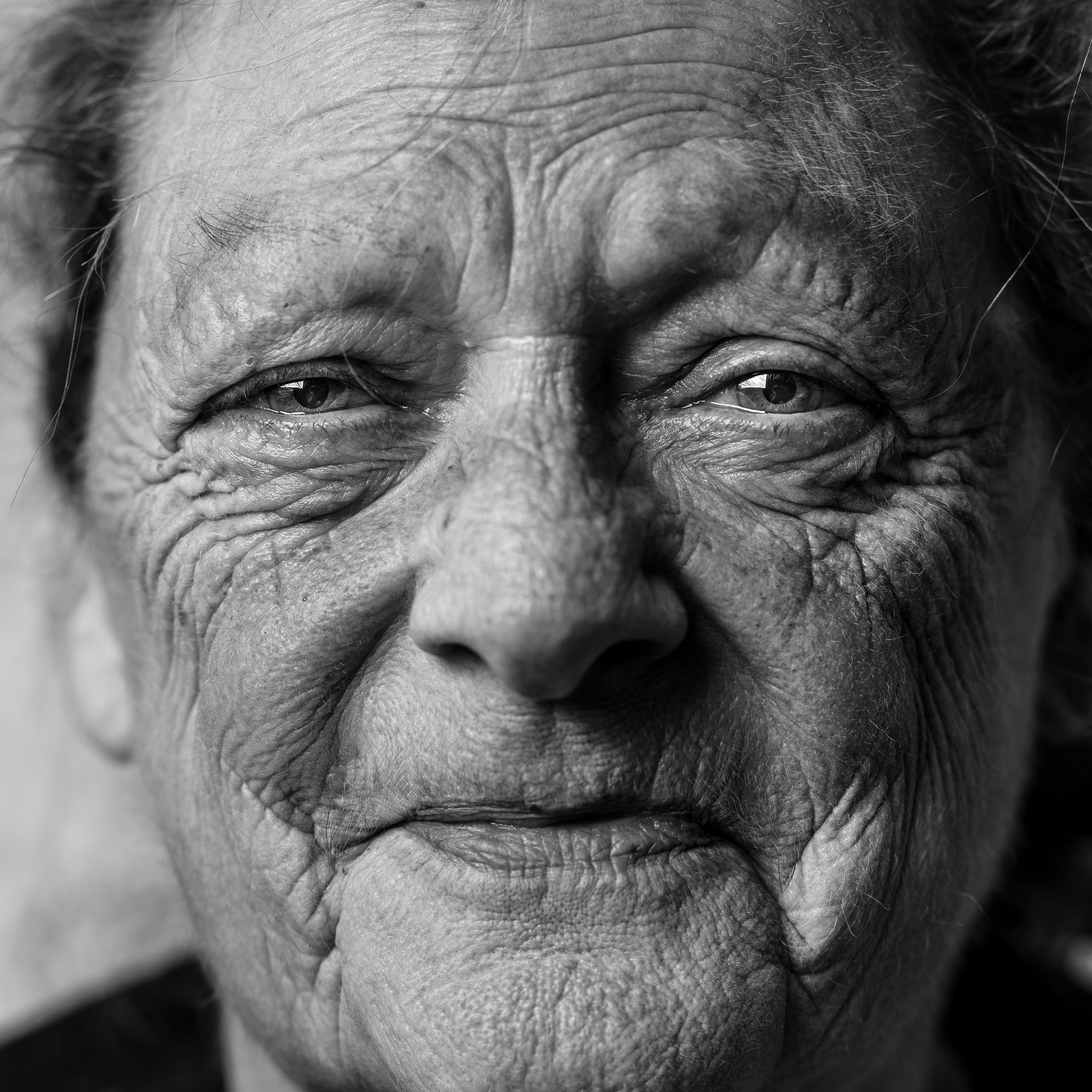Aging